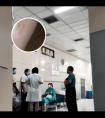 308激光治疗仪可以自己在家里面用吗安全吗