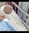 白癜风不用308照射会扩散吗