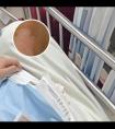 照完308激光还要抹他克莫司药效好