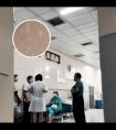 白斑308激光治疗变化