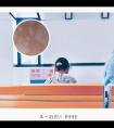 曲安奈德主要管啥的
