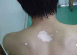 白颠疯医院在贵阳那里